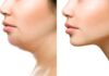 How are Non-Surgical Double Chin Removal Treatments Done?