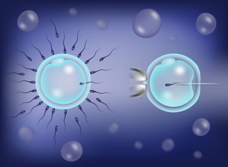 What is IVF Fertility and What Does It Mean for You?