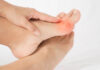 Bunions vs. Big Toe Arthritis: What’s the Difference? Bunions vs. Big Toe Arthritis