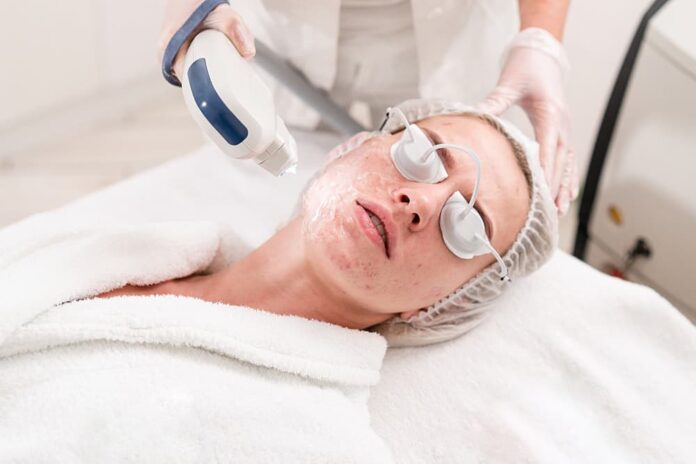 Non-Surgical Pico Laser for Acne Scars