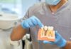 How Do Implants Help If I Have Partial or Full Dentures? Dental Implants