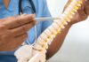 Spinal Stenosis Treatment