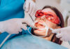 The Impact of Intraoral Scanning on Modern Dental Practices