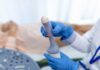 TV Ultrasound Philippines Guide: When Doctors Recommend a Transvaginal Ultrasound