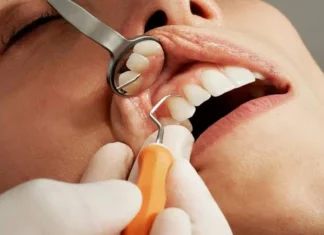 Does Medicaid Cover Dental Implants? The State Rules, the Exceptions, and What to Ask Practices Like Stubbs Dental